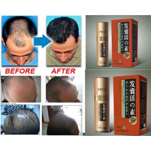 СРЕДСТВО ДЛЯ РОСТА ВОЛОС hair growth spray