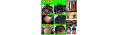 СРЕДСТВА ДЛЯ ВОССТАНОВЛЕНИЯ РОСТА ВОЛОС